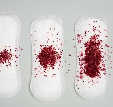 1744991036menstrual.jpg